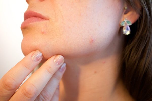 Bahaya Skincare Oplosan